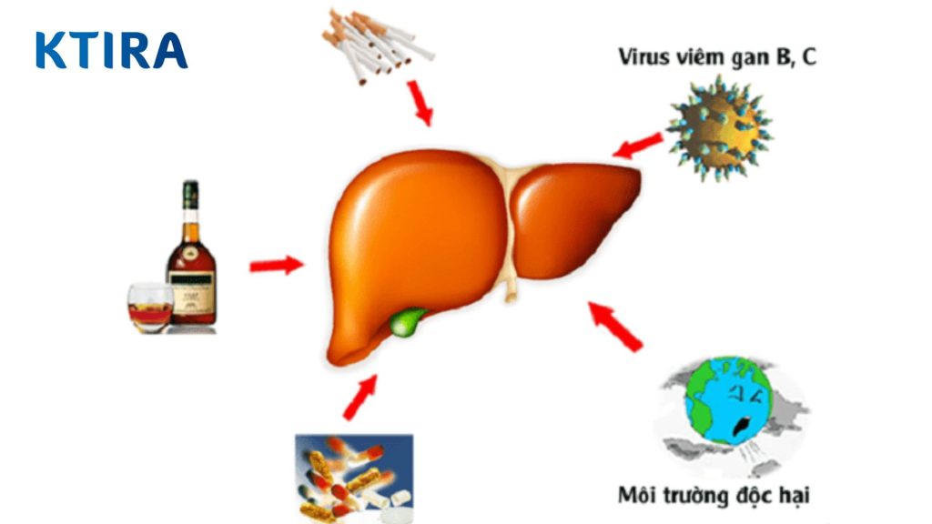 Nguyên nhân dẫn đến bệnh gan