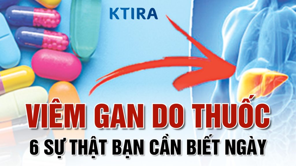 Bệnh viêm gan do thuốc