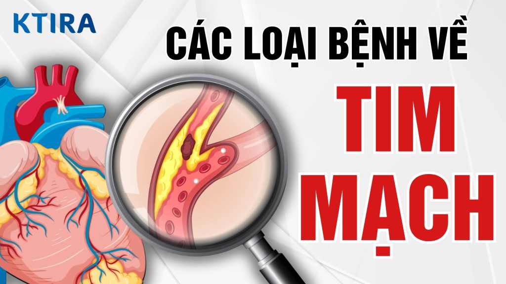 Các loại bệnh tim mạch