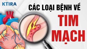 Các loại bệnh tim mạch