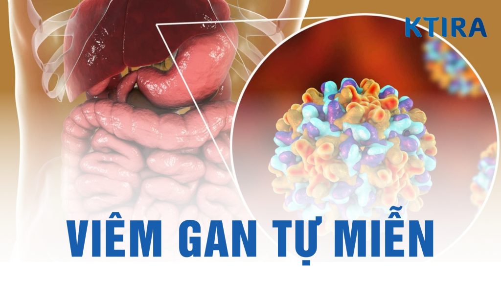 Viêm Gan Tự Miễn là gì