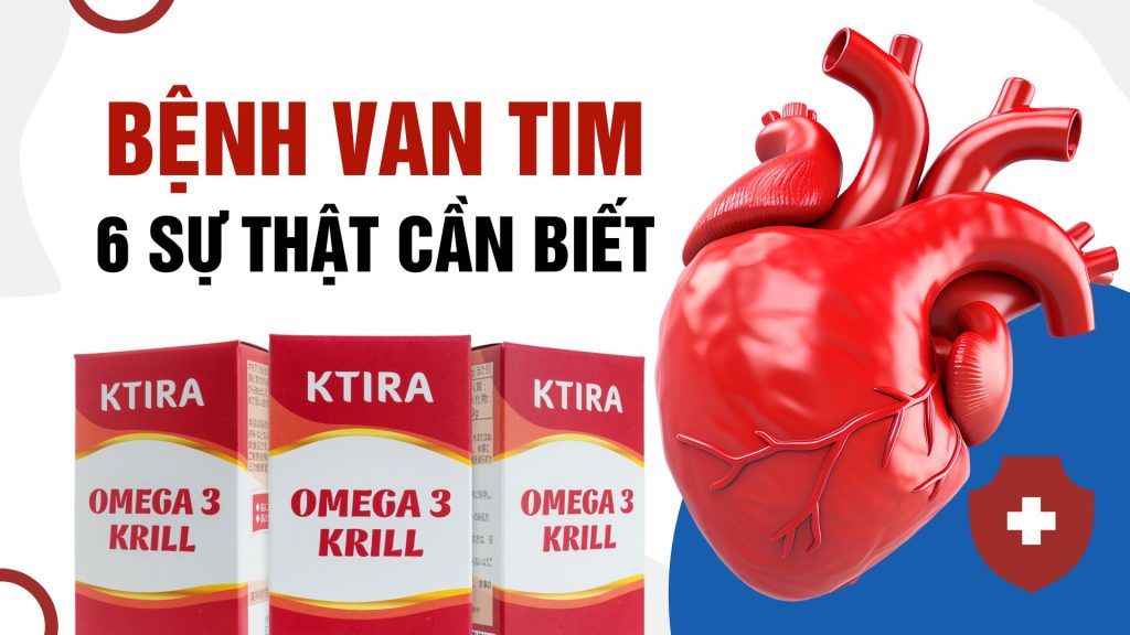 Bệnh van tim