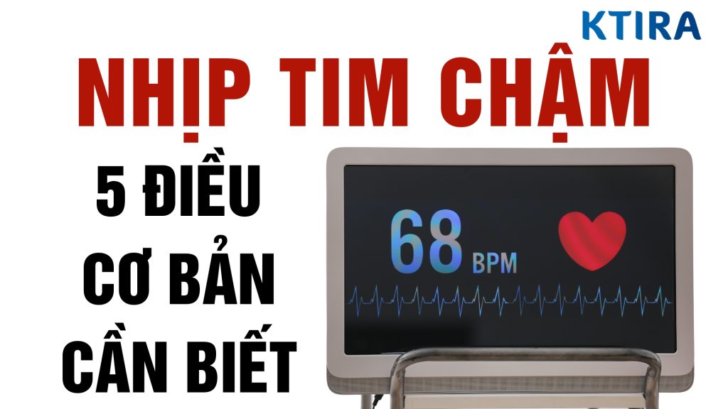 Nhịp tim chậm là gì