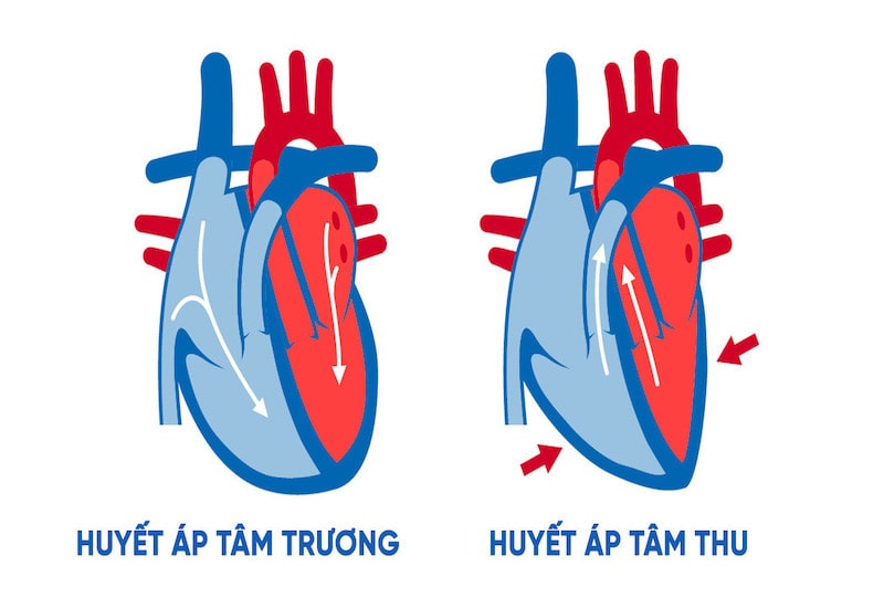 Minh họa huyết áp tâm trương - tâm thu