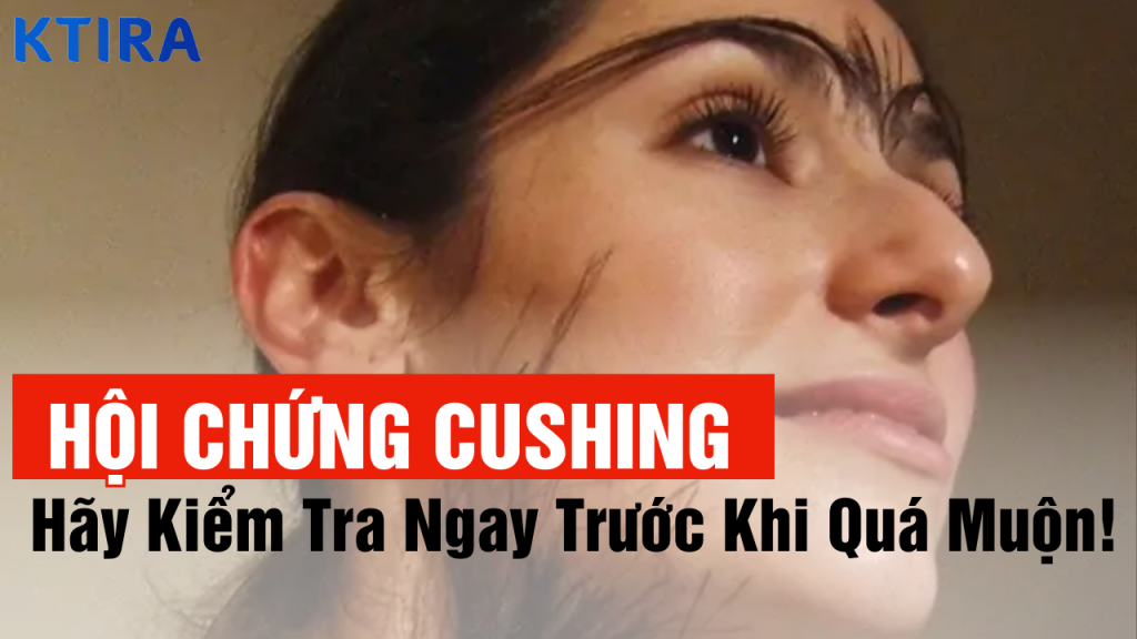 Hình Nền Hội Chứng Cushing