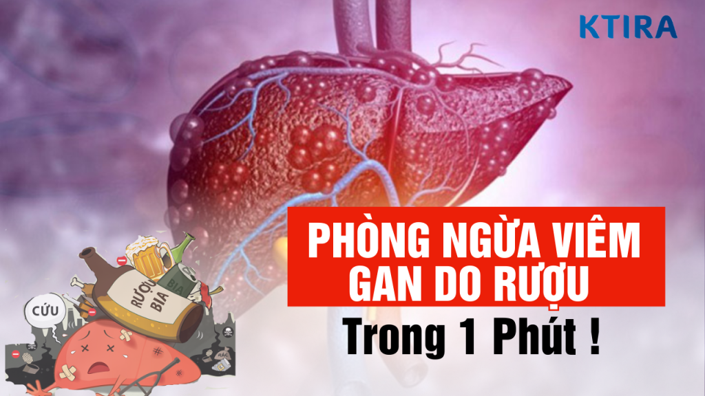 Viêm gan do rượu