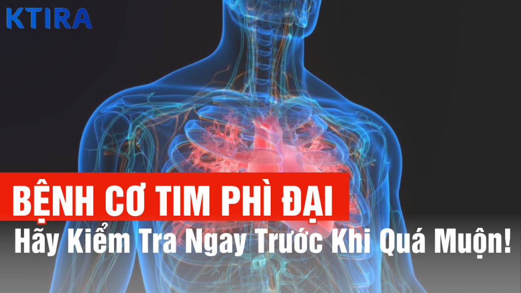 3 Triệu Chứng Cơ Tim Phì Đại Mà Bạn Chưa Biết