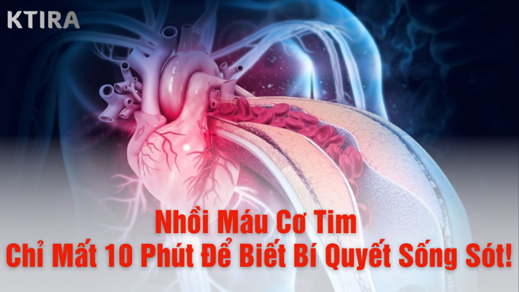 Bí quyết sống sót dau nhồi máu cơ tim