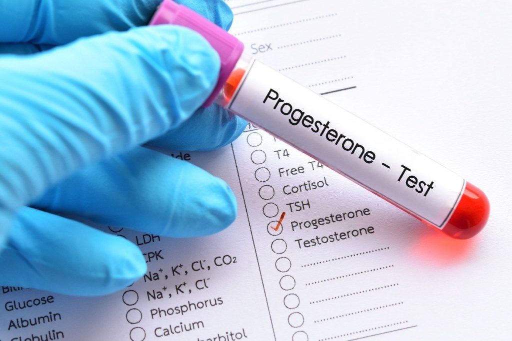 Minh họa xét nghiệm progesterone