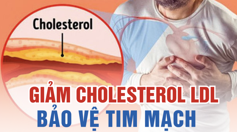 Giảm cholesterol LDL cao để bảo vệ sức khỏe tim mạch hiệu quả hơn