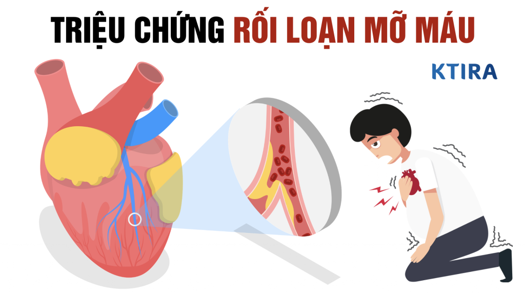 triệu chứng nhồi máu cơ tim ktira