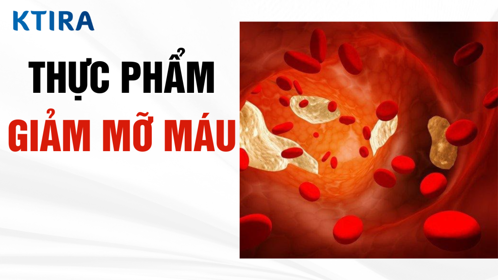 Bí quyết giảm mỡ máu với 5 siêu thực phẩm