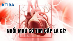 Nhồi máu cơ tim cấp là gì? 5 điều cần biết về nhồi máu cơ tim cấp