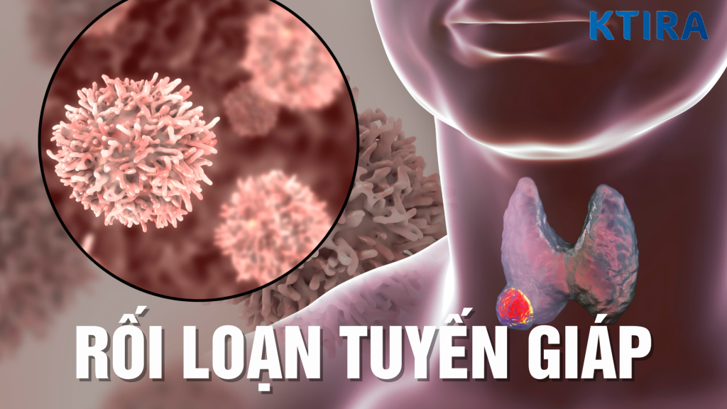 Rối loạn tuyến giáp: Nguyên nhân, triệu chứng và biện pháp phòng ngừa