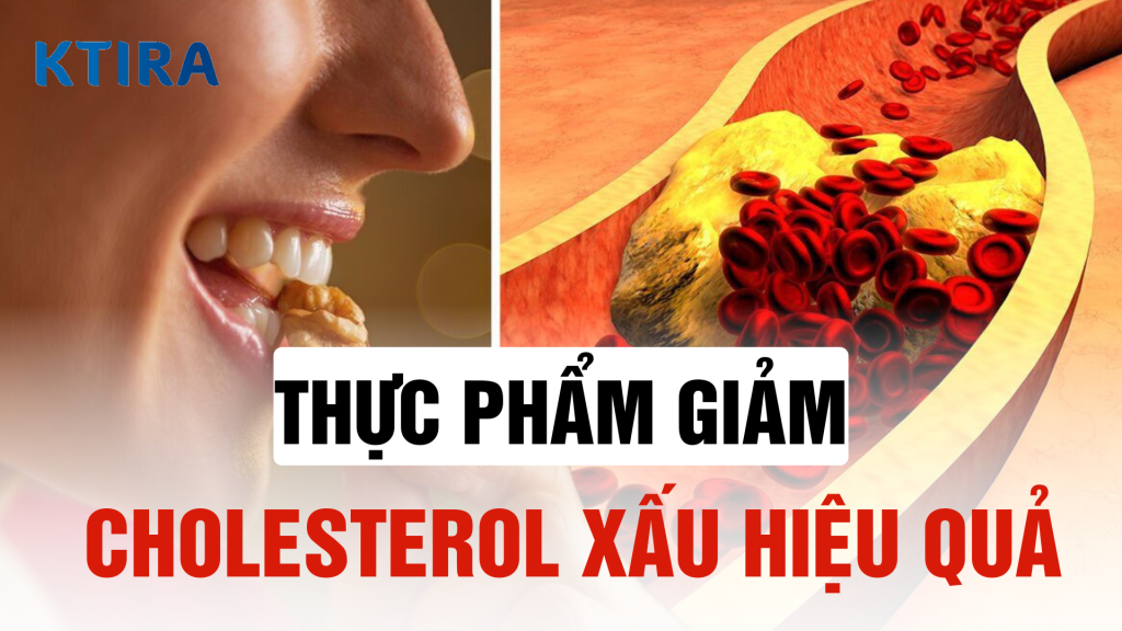 5 thực phẩm giảm cholesterol xấu hiệu quả