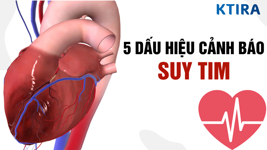 Suy tim và dấu hiệu cảnh báo suy tim sớm