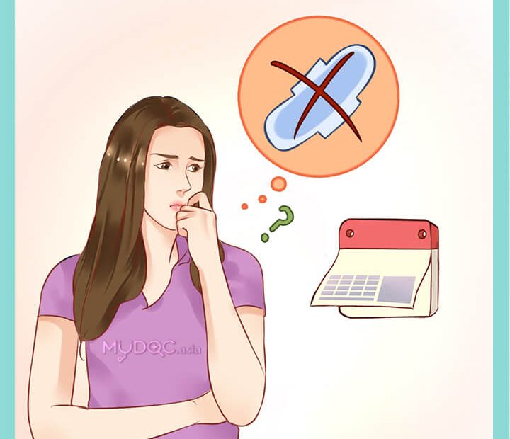 Kinh nguyệt mất tích