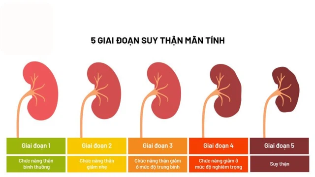 Ai dễ bị suy thận