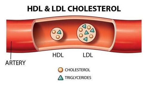 2 chỉ số cholesterol chính