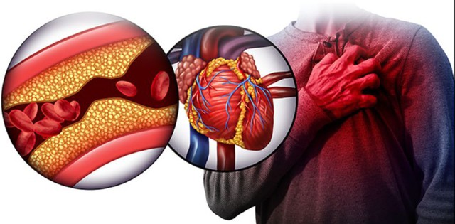 Khám phá 5 thực phẩm giảm mỡ máu hiệu quả