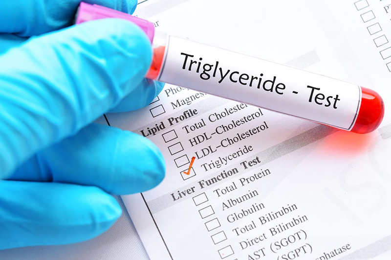 Chỉ số triglyceride bình thường