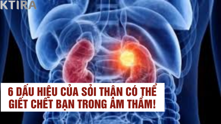 Sốc: 6 Dấu Hiệu Của Sỏi Thận Có Thể Giết Chết Bạn Trong Âm Thầm!