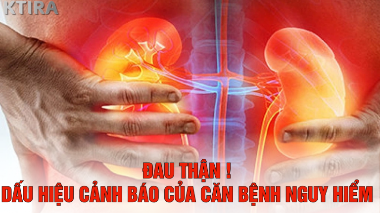Đau thận: Dấu hiệu cảnh báo sớm của căn bệnh nguy hiểm mà 90% người mắc không hay biết!