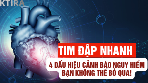 tim đập nhanh và 4 dấu hiệu cảnh báo