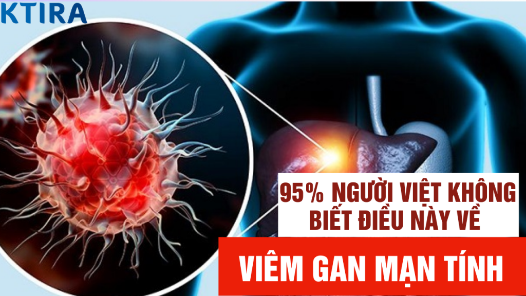 viêm gan mạn tính và điều bạn chưa biết