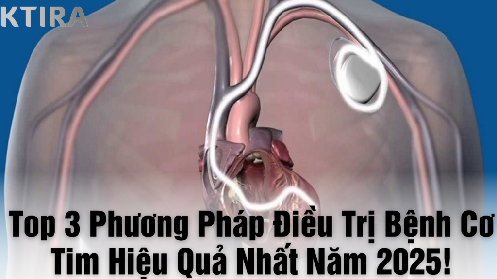 Phương pháp điều trị bệnh cơ tim