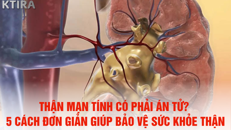 Thận Mạn Tính Có Phải Án Tử? 5 Cách Đơn Giản Giúp Bảo Vệ Sức Khỏe Thận Ngay Hôm Nay!