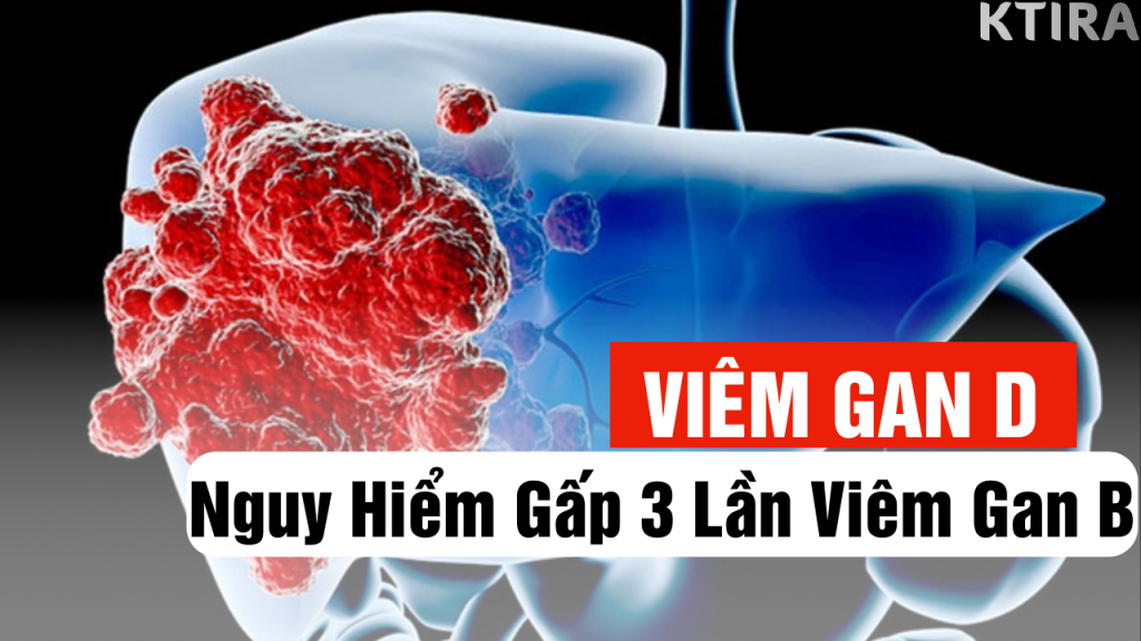 mức độ nguy hiểm của viêm gan D