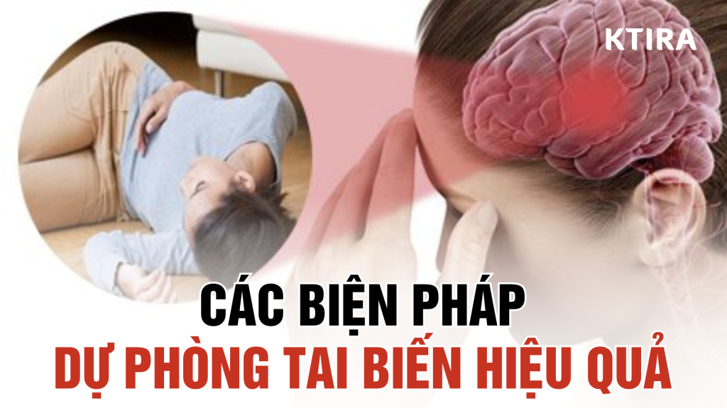 dự phòng tai biến ktira
