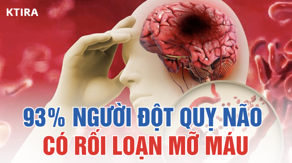 Mỡ Máu Cao Và Nguy Cơ Đột Quỵ ktira