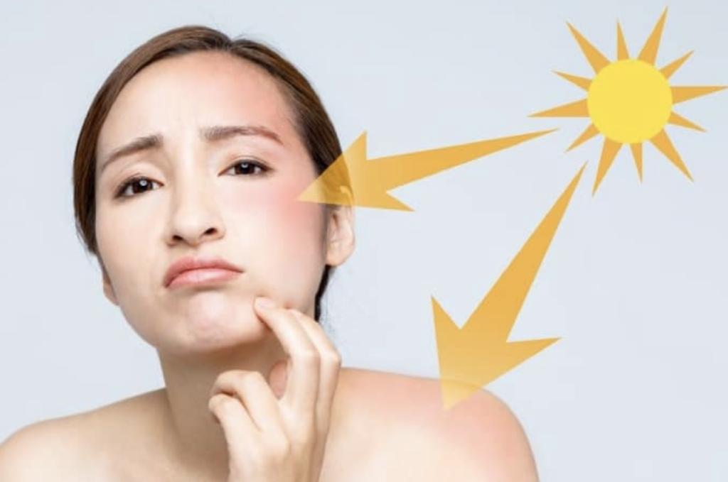 Yếu tố gây lão hóa sớm Ktira