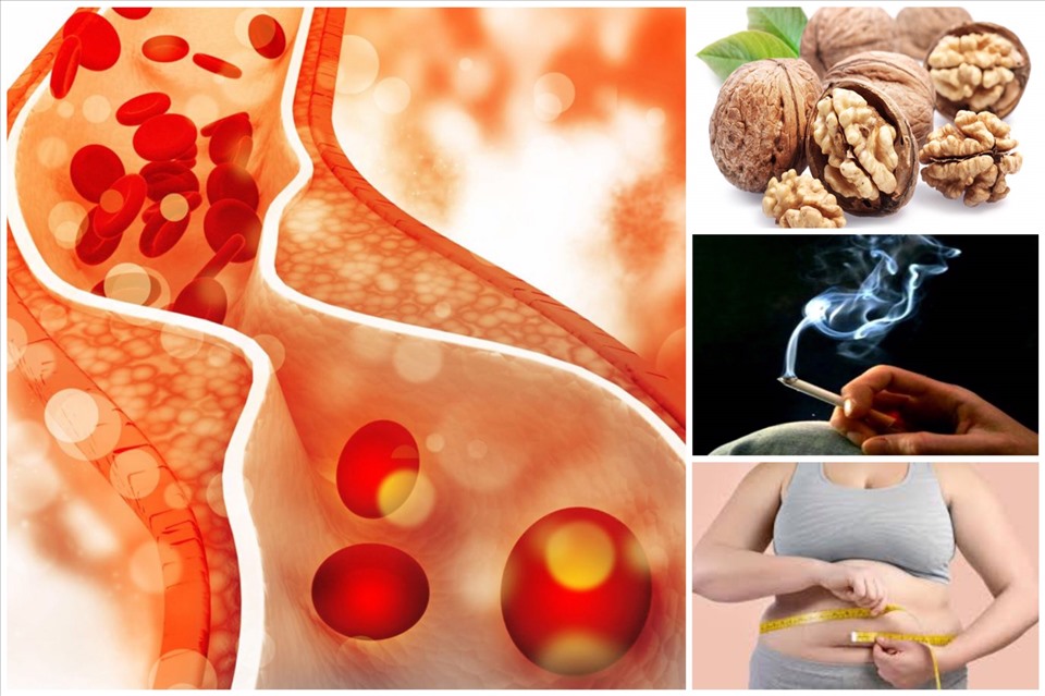 Bí quyết bảo vệ mạch máu