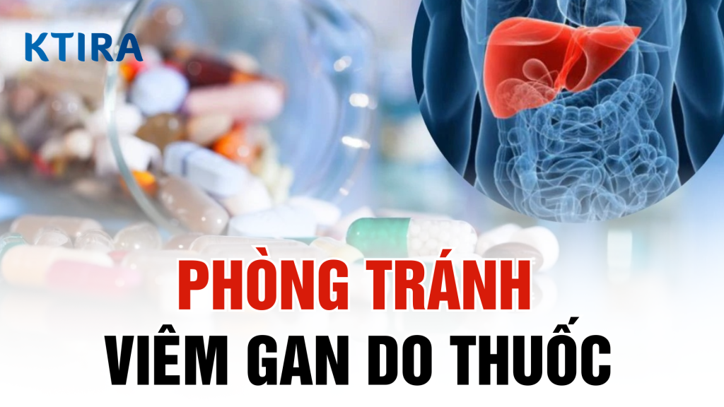 Giải pháp phòng tránh viêm gan do thuốc