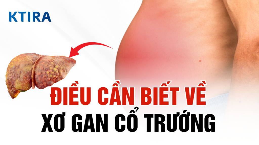 Xơ gan cổ trướng