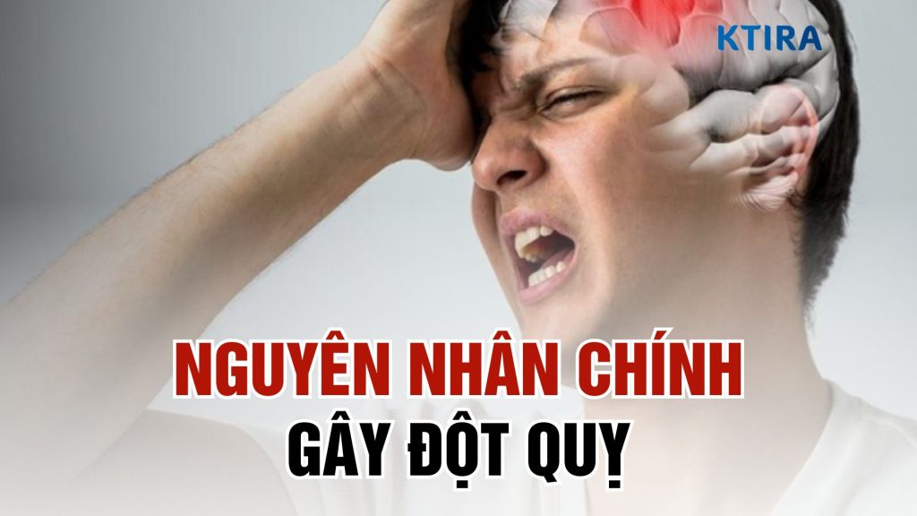 Dấu hiệu đột quỵ