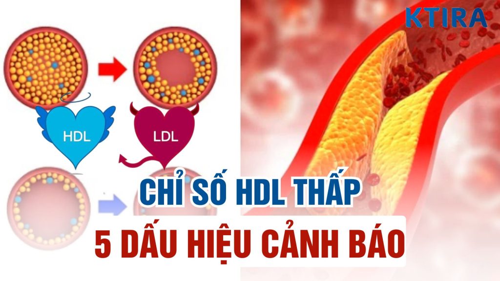 Chỉ số HDL thấp là gì?
