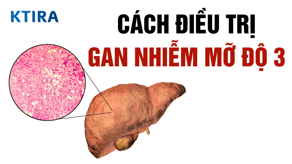 Hiểu về gan nhiễm mỡ độ 3