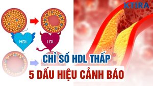 Chỉ số HDL thấp là gì?