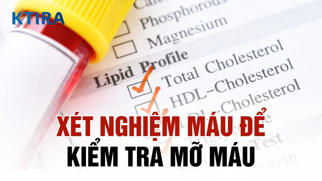 Xét nghiệm máu để kiểm tra mỡ máu