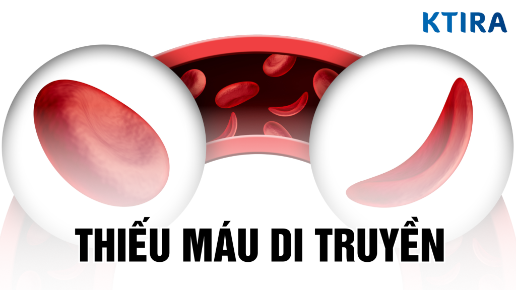 Thiếu máu di truyền