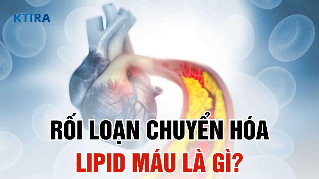 Rối loạn chuyển hóa lipid máu