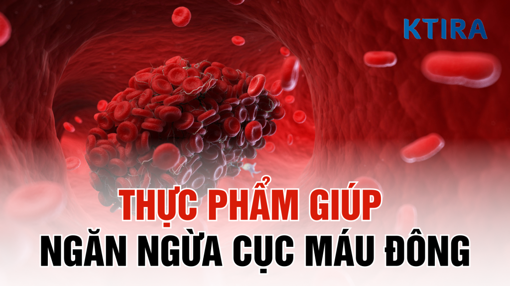 Ngăn ngừa cục máu đông hiệu quả