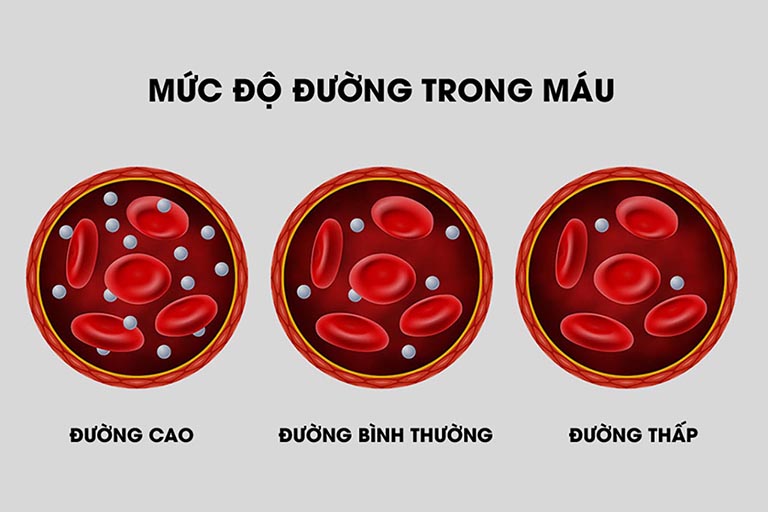 kiểm soát đường huyết ktira