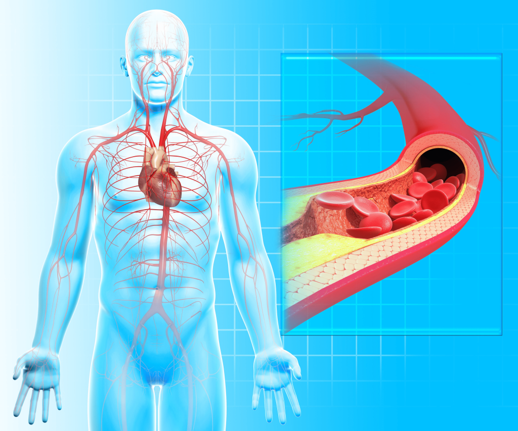 Nguyên nhân gây huyết áp cao khi ngủ