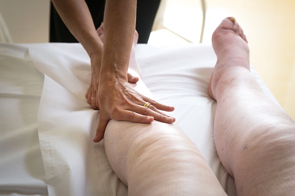 Triệu chứng phù nề cơ thể