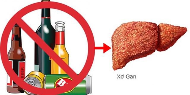 Triệu chứng bệnh xơ gan